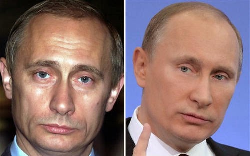 раздражение на подбородке от слюней у ребенка фото с пояснениями