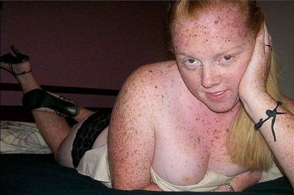 Freckles big ass