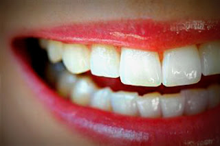 Alba Clinica dental higiene dental professional Neteja dental professional a Reus i Tarragona
