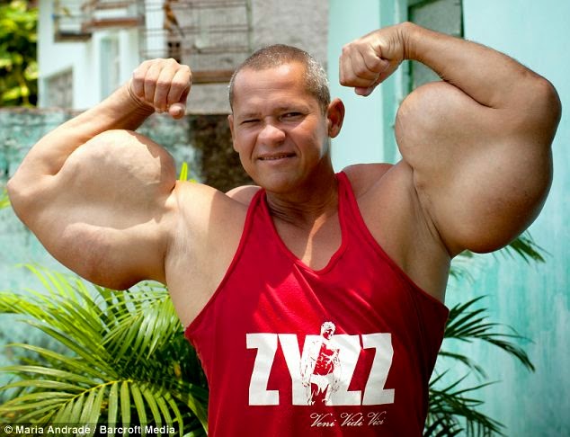 Celebrities and bodybuilding photos: The Grossest Synthol Freaks
