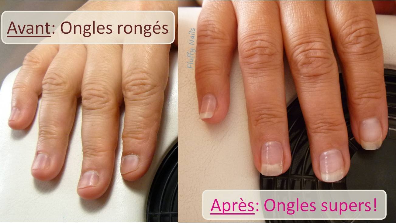 Comment arrêter de se ronger les ongles grâce aux faux,ongles en gel?