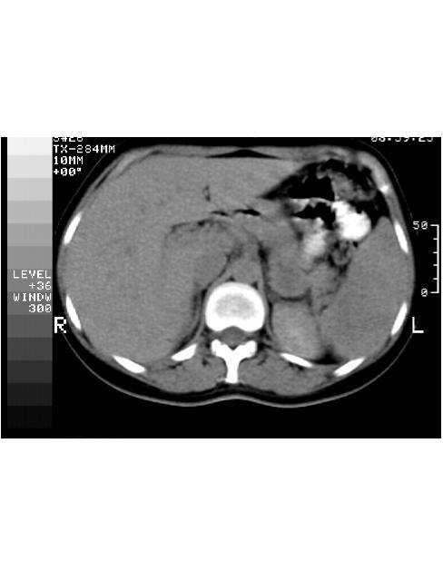 De la espalda duele el cuello y la cabeza