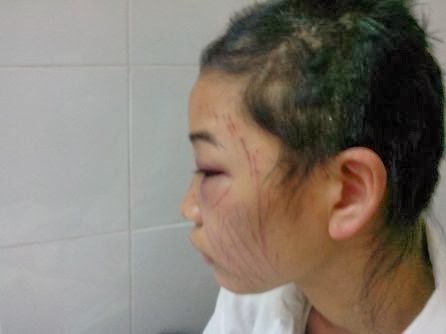 Bị bạo hành mà không hiểu vì sao