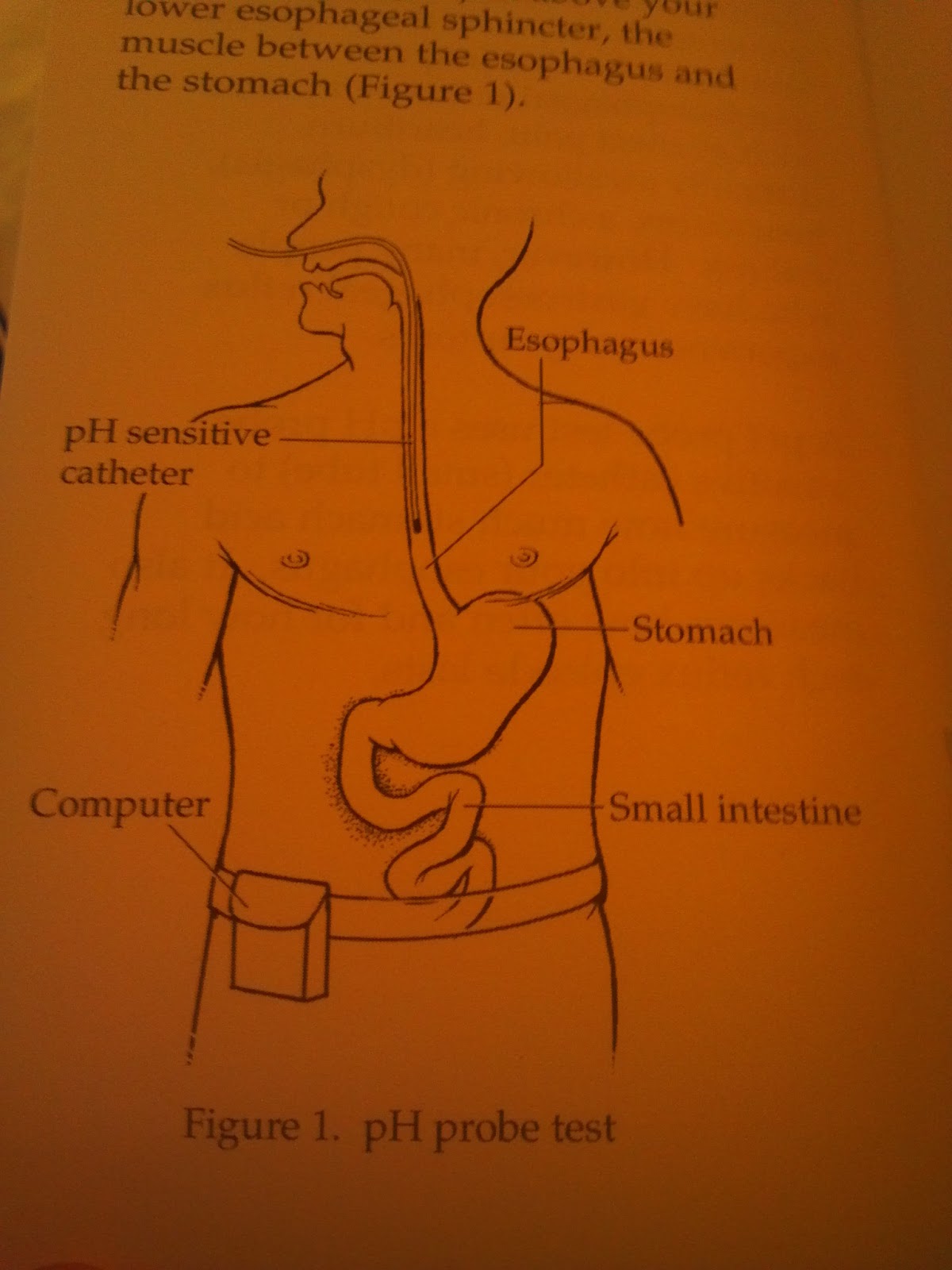 Illustration of where the pH Probe goes.