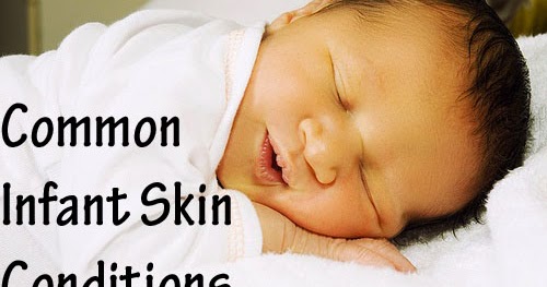 View Intertrigo Baby Treatment Gif