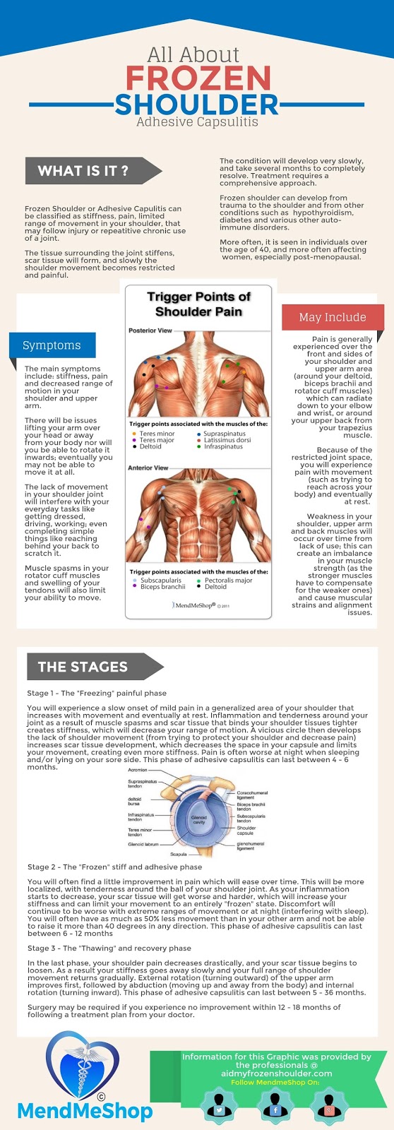 Treatments for Frozen Shoulder July 2015
