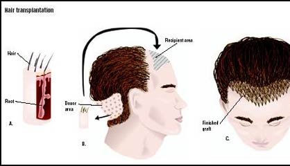 hair fall treatment tips