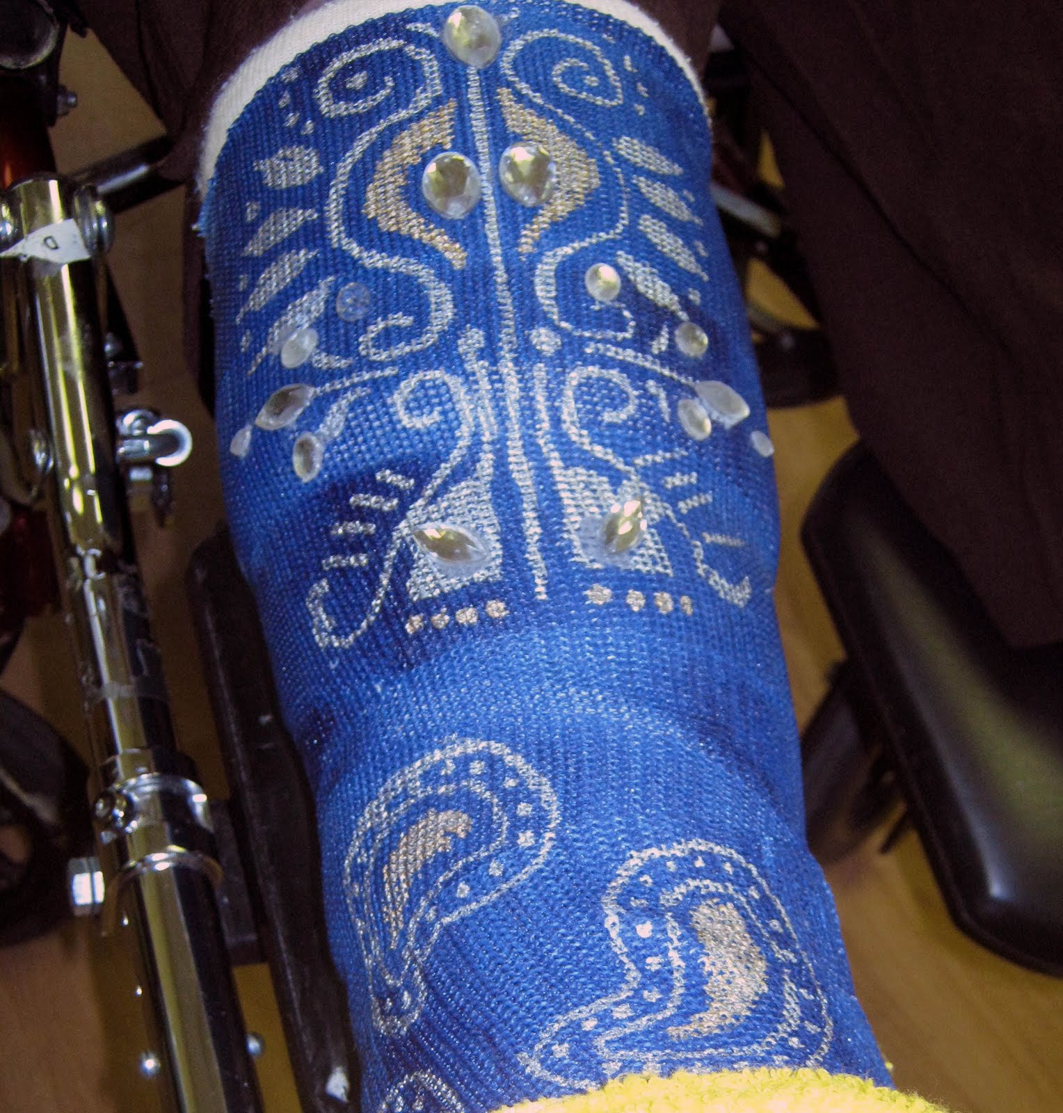 27 best Fabulous Arm Casts images on Pinterest Arm cast, Cast art and