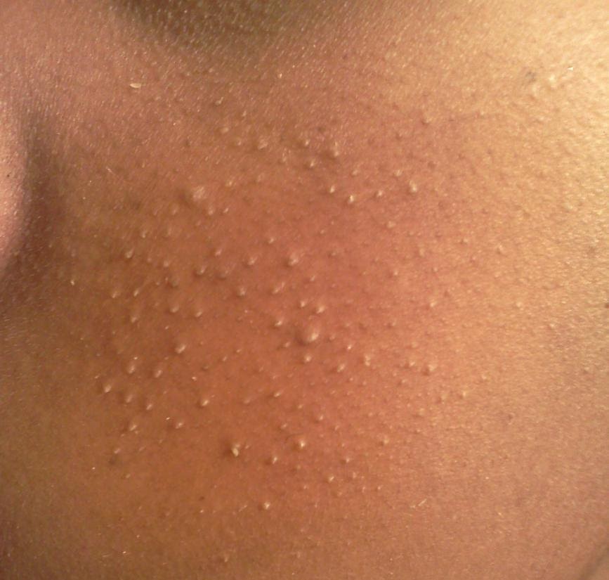 Purging questions what should I do during one and how fast could it