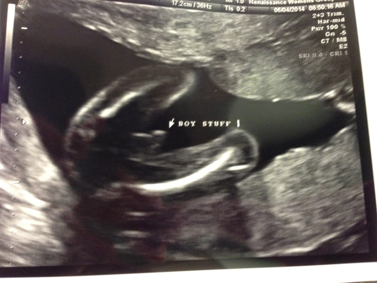 size of baby at 21 weeks heart impulsar co