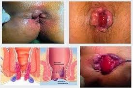 Ambein Luar Ambein Luar
