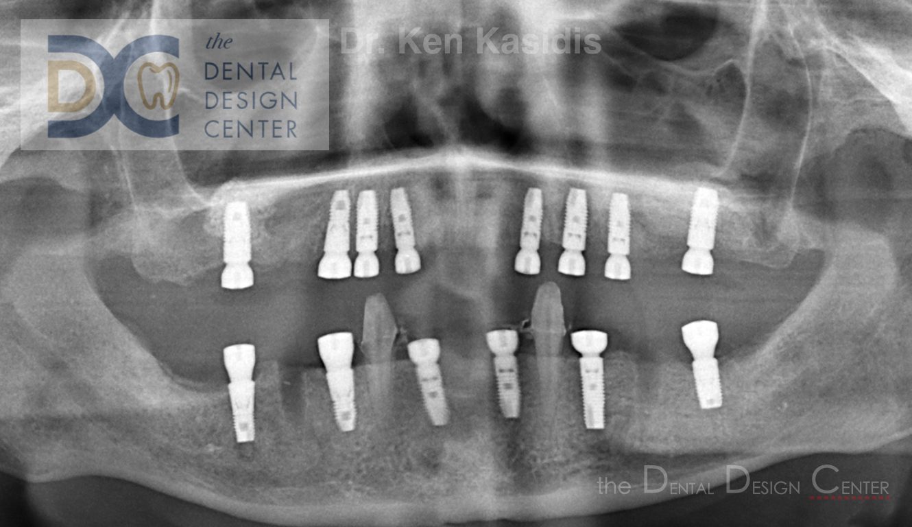 dental%2Bdesign%2Bcenter%2Bx ray