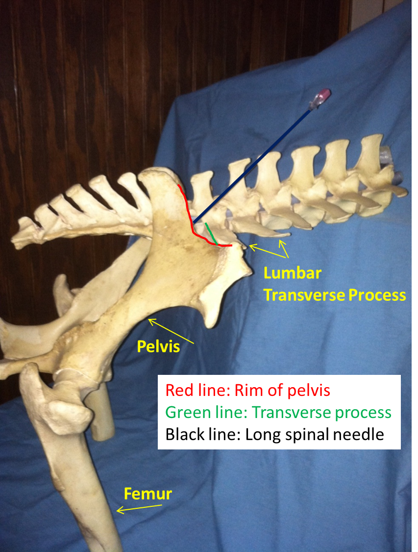 Michael Porter, Equine Veterinarian Sacro Iliac Injection!