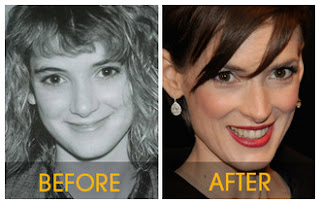 Winona Ryder Nose Job