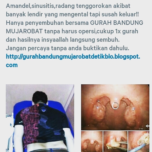 Gurah mata Pernafasan THT bekam & Penyakit MATA Tlp via wa 081320428111