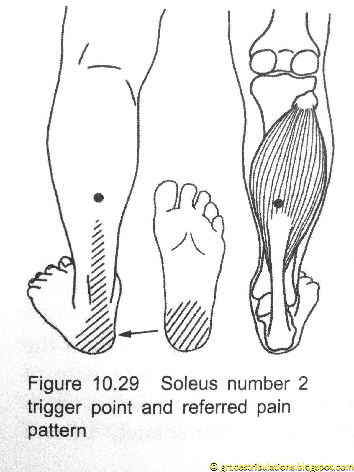 Pain In Body