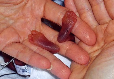 Asian News 10 Hal Unik Terkecil Di Dunia