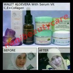 1351173799_449822712_1-Gambar--Cream-Walet-Aloevera-Plus-Serum-Vit-C.jpg