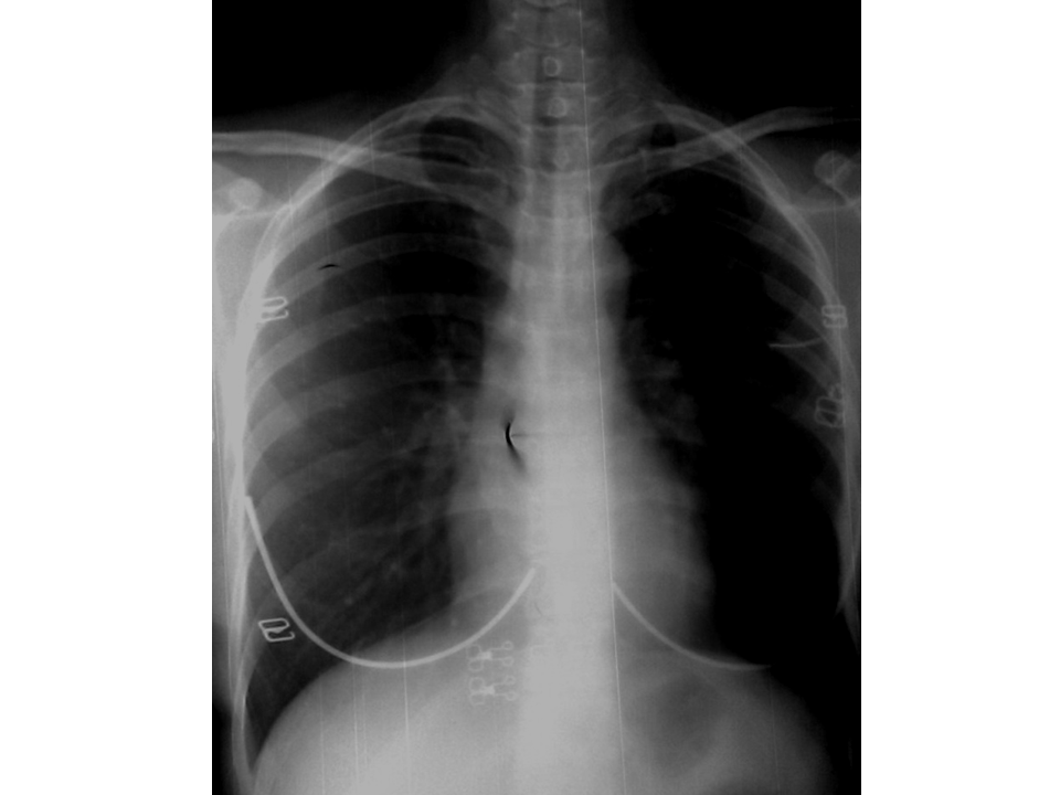 VIETNAMESE MEDIC ULTRASOUND CASE 193 MEDIC RADIOLOGY CASE 07