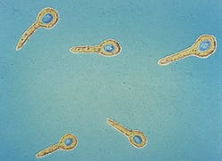 Vi khuẩn Clostridium tetani. Nguồn: Textbook of bacteriology.