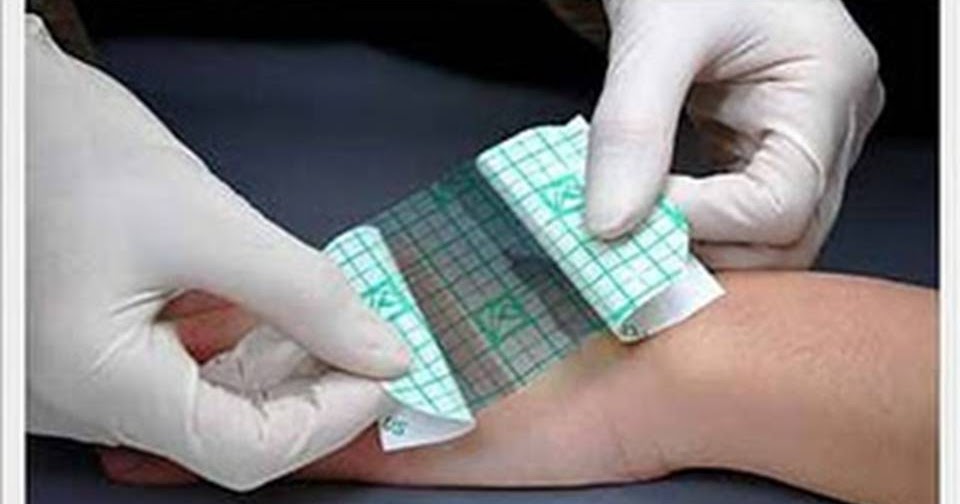 Perawatan Luka Pekanbaru MODERN DRESSING