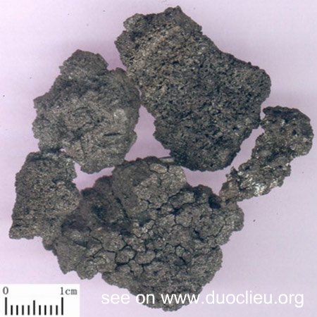 Carbonized human hair (Xueyutan)