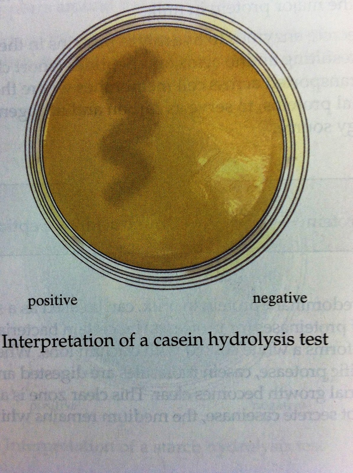Gram negative bacteria in gelatin hydrolysis test flbasta