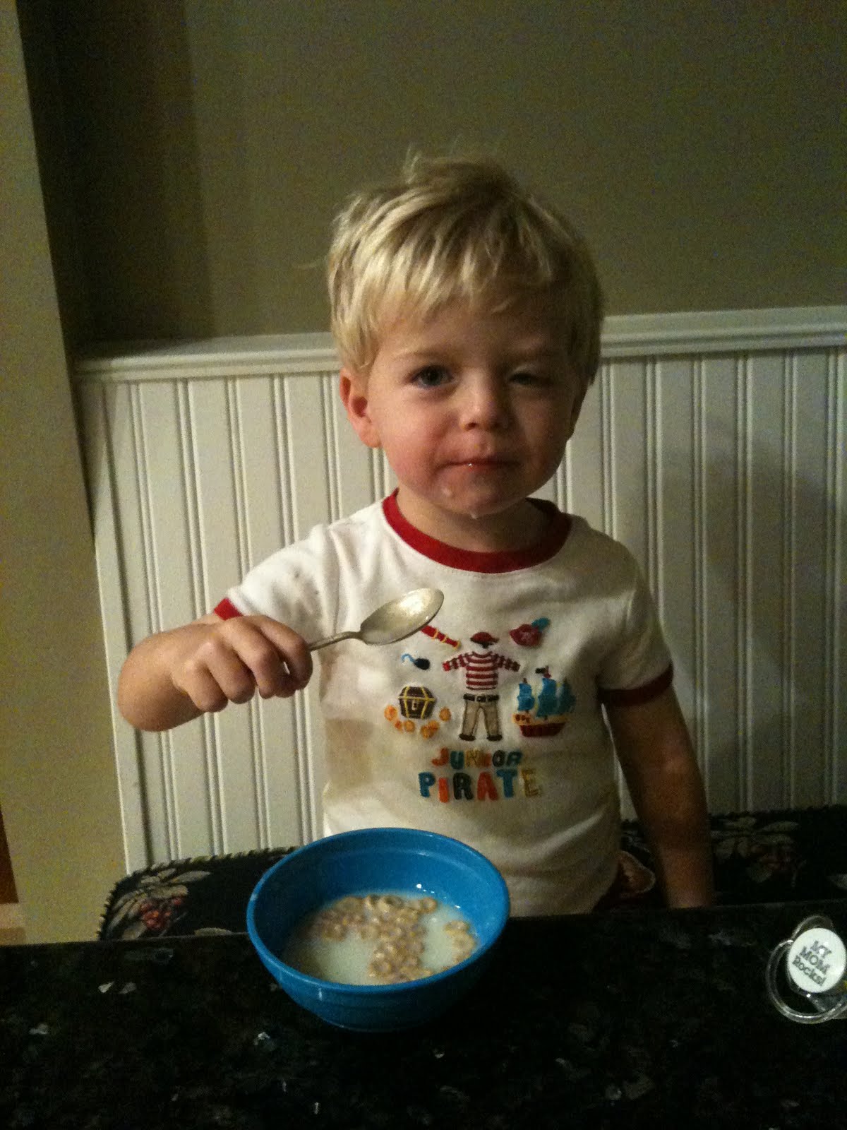 Congenital Ptosis Photos 12+ months after frontalis sling surgery