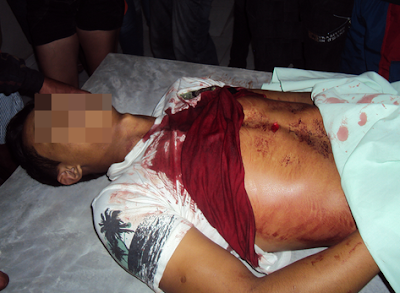 Jovem morto a golpes de faca em Santo Aleixo Jovem morto a golpes de faca em Santo Aleixo
