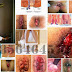 Obat Tradisional Obati Wasir Parah thumbnail