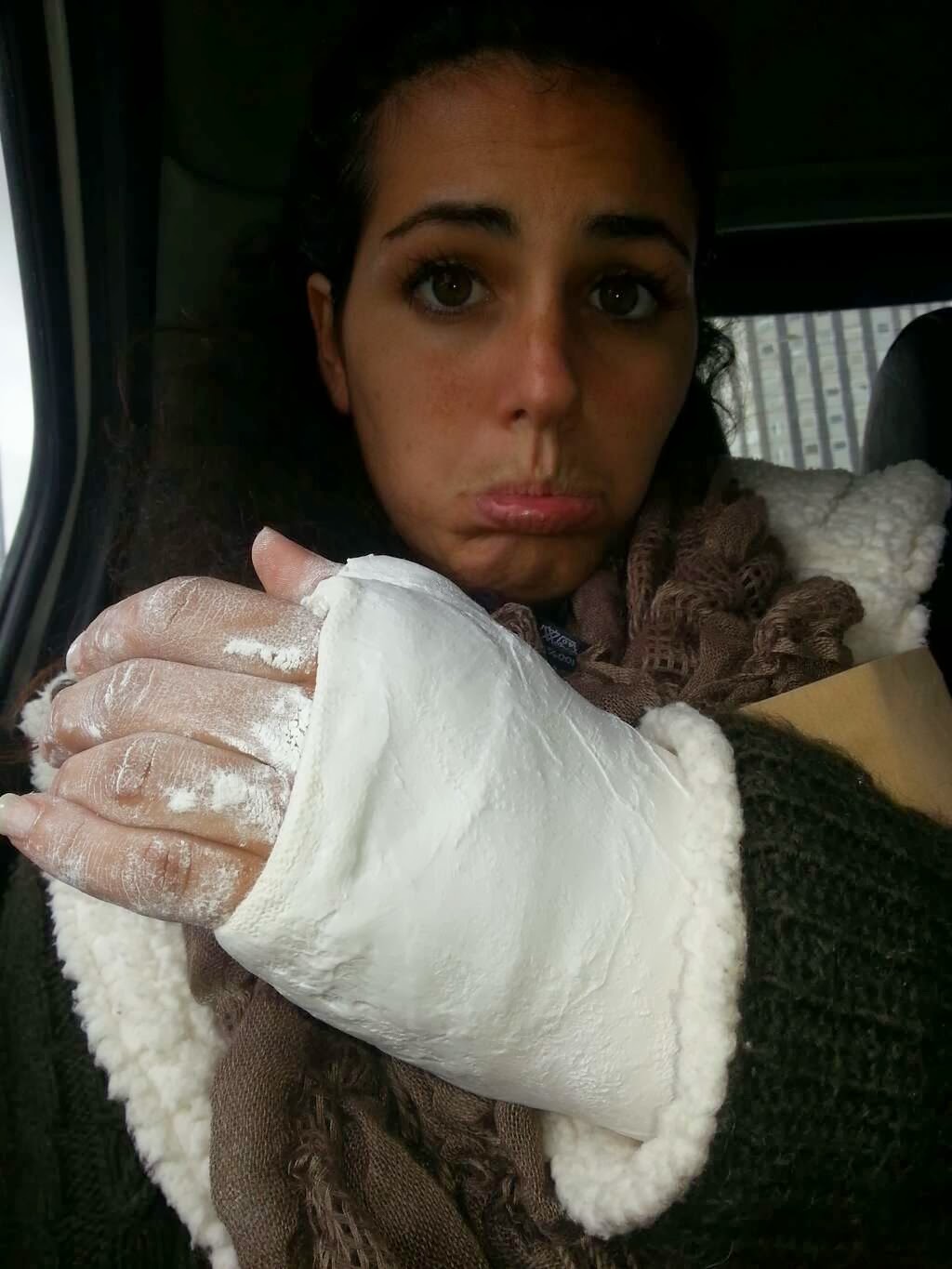 Cyber Arm Cast December 2014