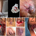 Obat Ambeien Rekomendasi Dokter Spesialis Wasir thumbnail