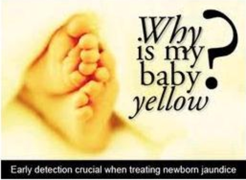 The Yellow Baby Neonatal JaundiceSmart Baby for Smart Parent