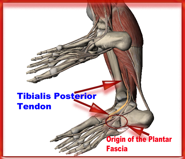 Heel Discomfort