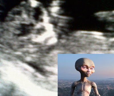 bebe extraterrestre en el vientre de una mujer