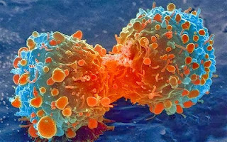 19 τρόποι δολοφονίας μας με… καρκίνο που πρέπει να γνωρίζουμε ...
