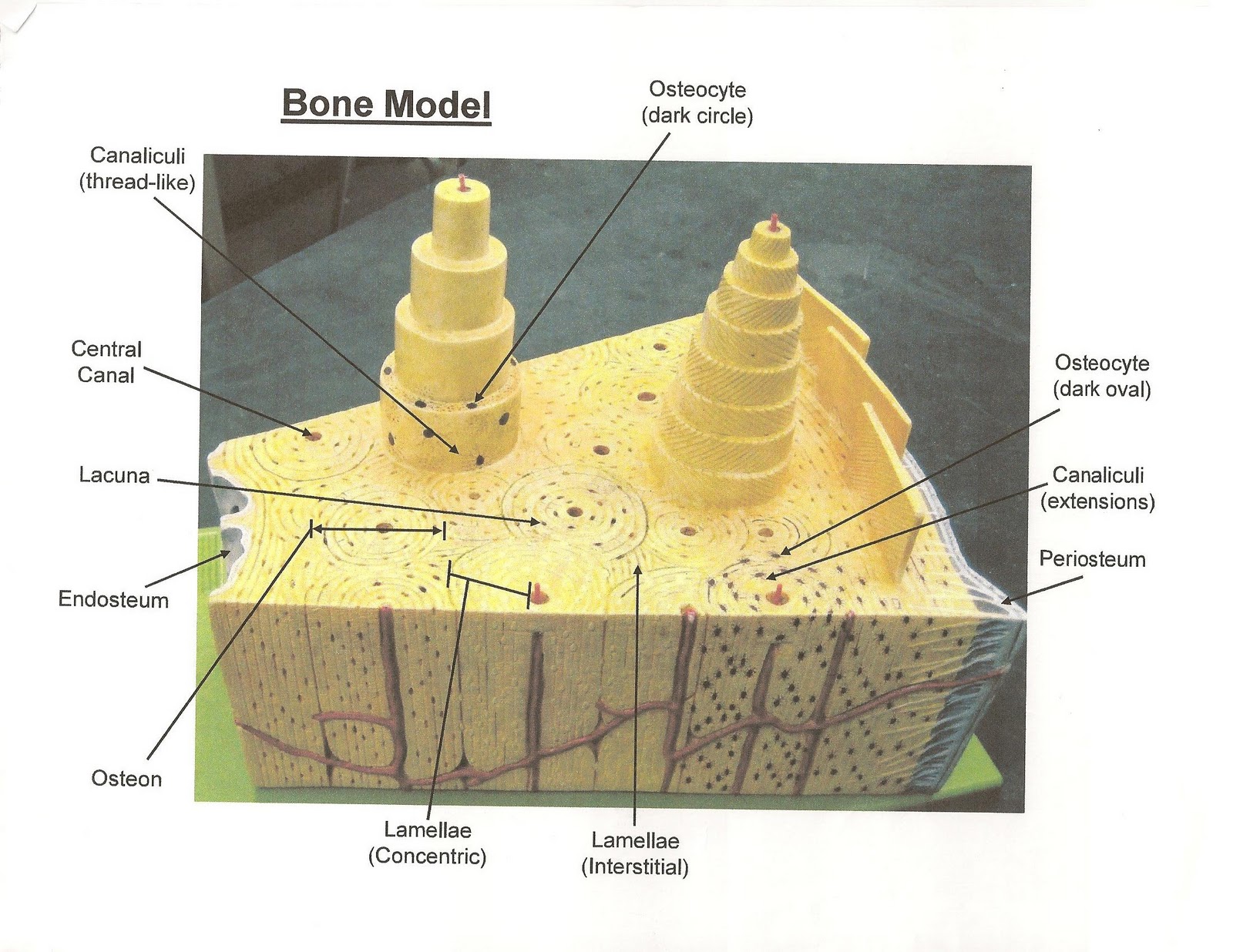 model of bone