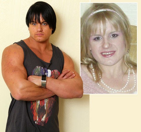 Steroid abuse female