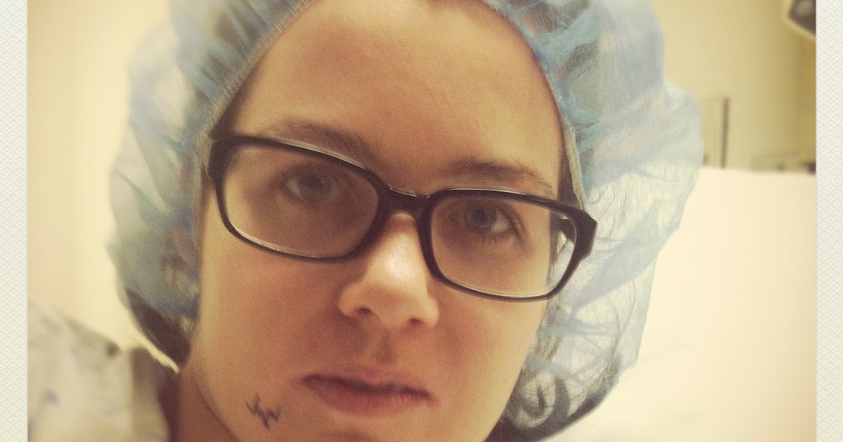 my crooked jaw scar tissue