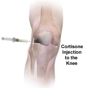 cortisone steroid injection cortisone steroid injection