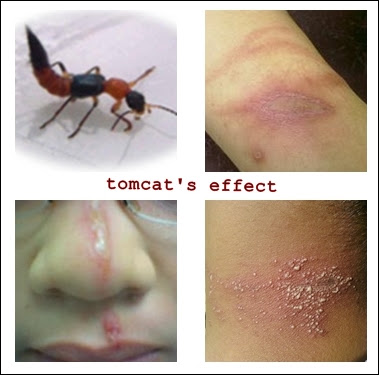 Gambar korban serangga tomcat