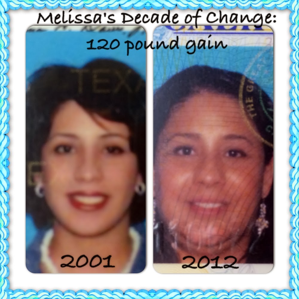 Top 105+ Pictures Cushing's Syndrome Cushing's Disease Before And After