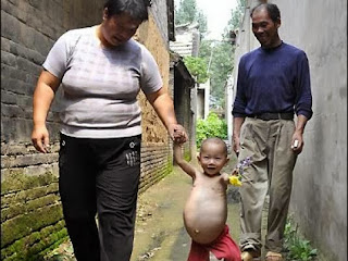 طفله صينية عمرها عام واحد ولكنها " حامل "  %D8%B7%D9%81%D9%84%D9%87+%D8%AD%D8%A7%D9%85%D9%84