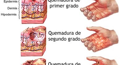 Que no es posible a varikoze de los ejercicios físicos