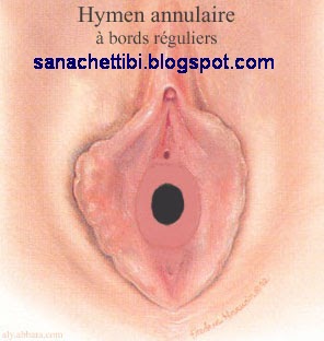 رجل القلب البارد غشاء البكارة بالصور الحقيقية Pics Photos Of Hymen