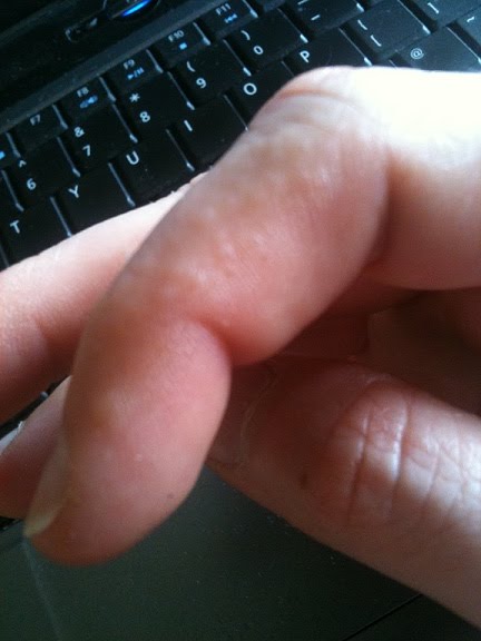 I Have Seen The Whole Of The Internet Summer Finger Bumps