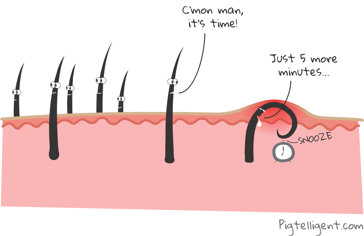 My Body Hair Shaving Experience, Tips, Product Crazy