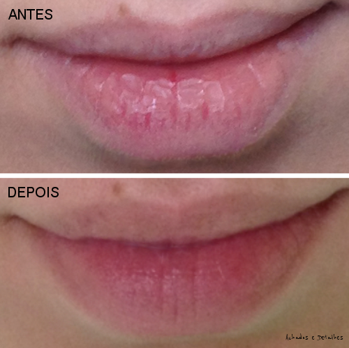 Achados e Detalhes: Resenha: CICAPLAST BAUME B5 da La Roche-Posay