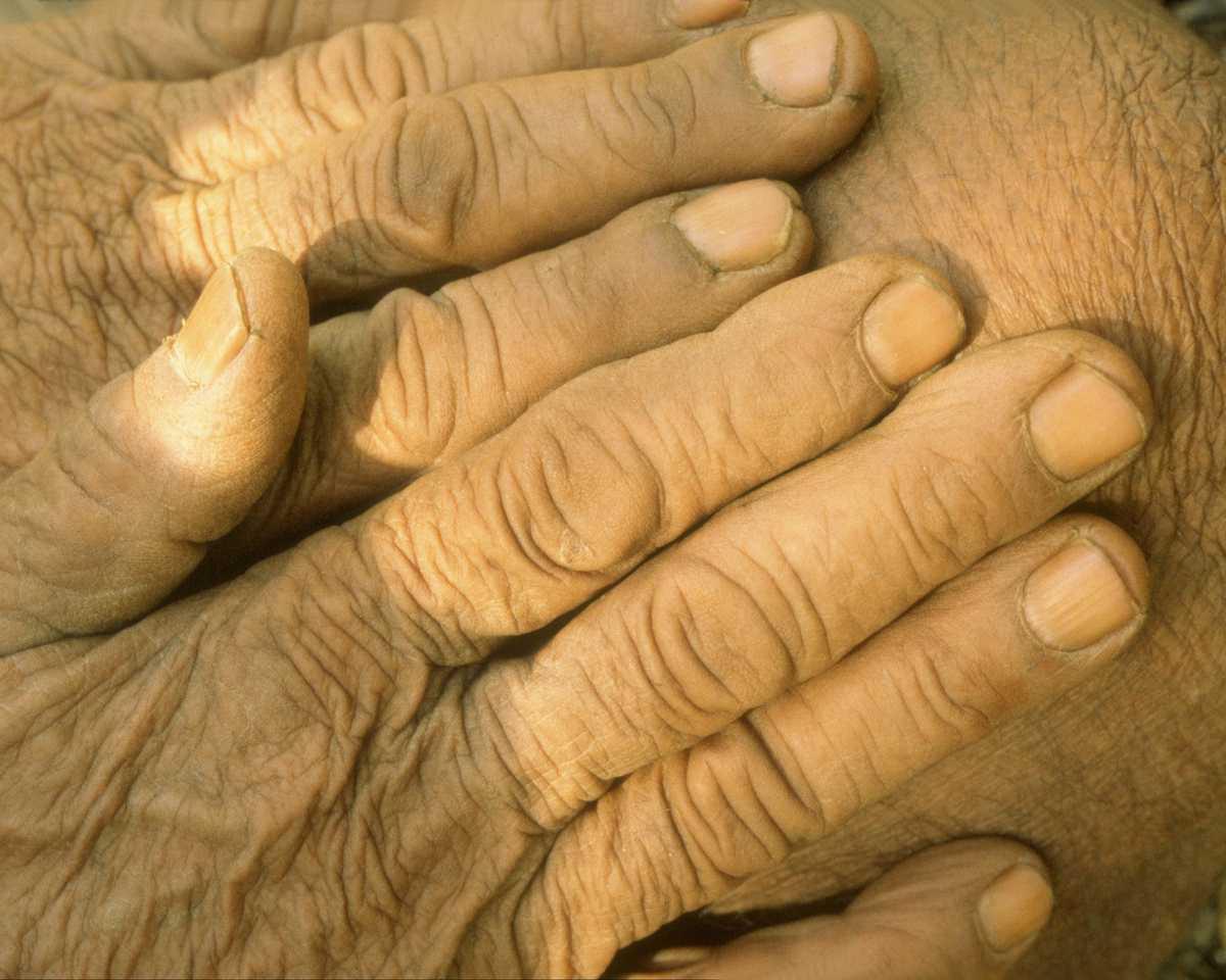 Wrinkled Hands