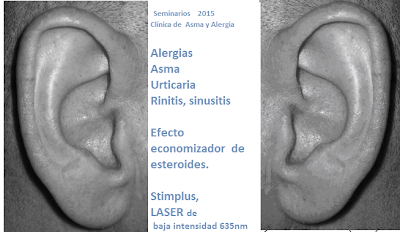 Aurículo Diagnosis y Terapia